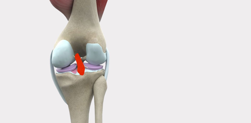 Archives des Pathologie de la rotule - Chirurgie du genou Geneve